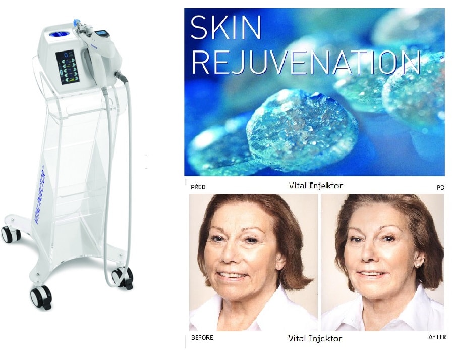 Ultimate SKin Rejuvenation