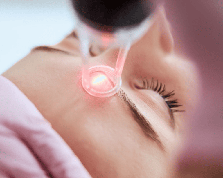 Specialized Laser Treatments
