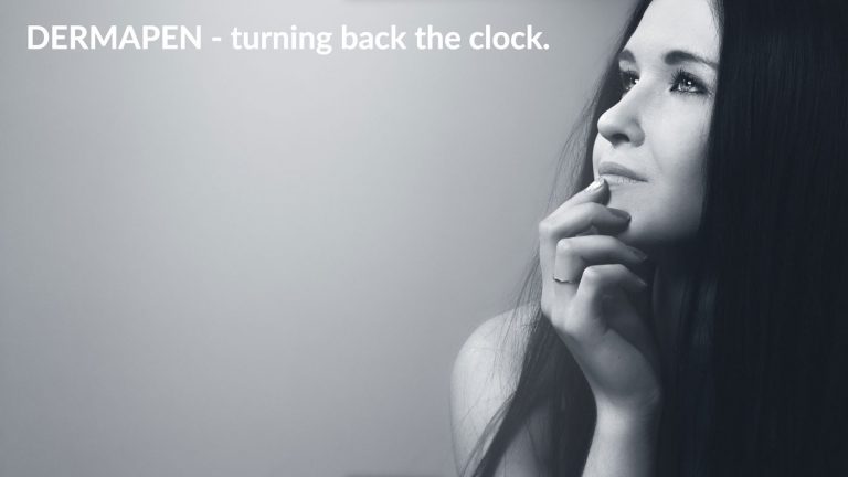 All you need to know about the Dermapen treatment