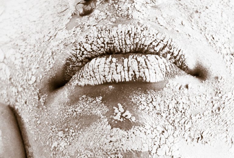 Why skin is drier in the winter months, and how to remedy it