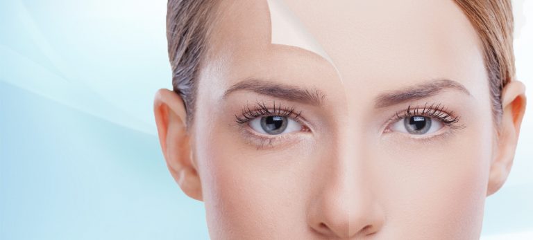 Retinol Peels