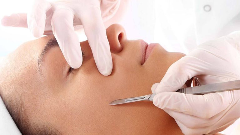 What is dermaplaning?