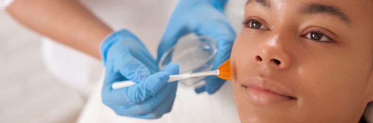 5 Chemical Skin Peels, What They’re For And What To Expect